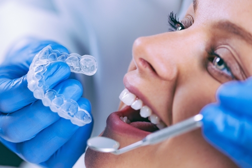 Treatment with Transparent Plates | Dent Elitium
